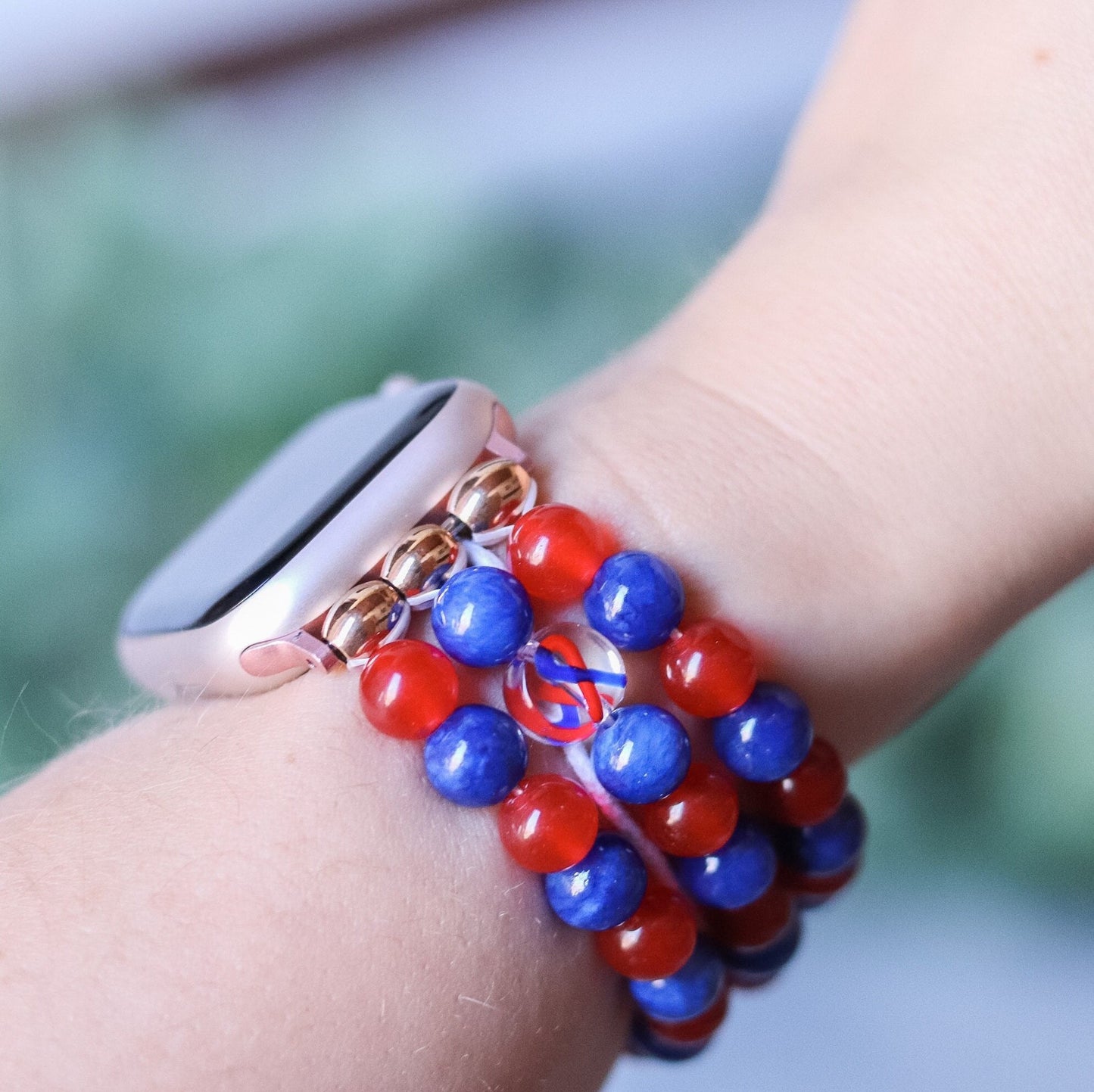 Congenital Heart Defect CHD Watchband